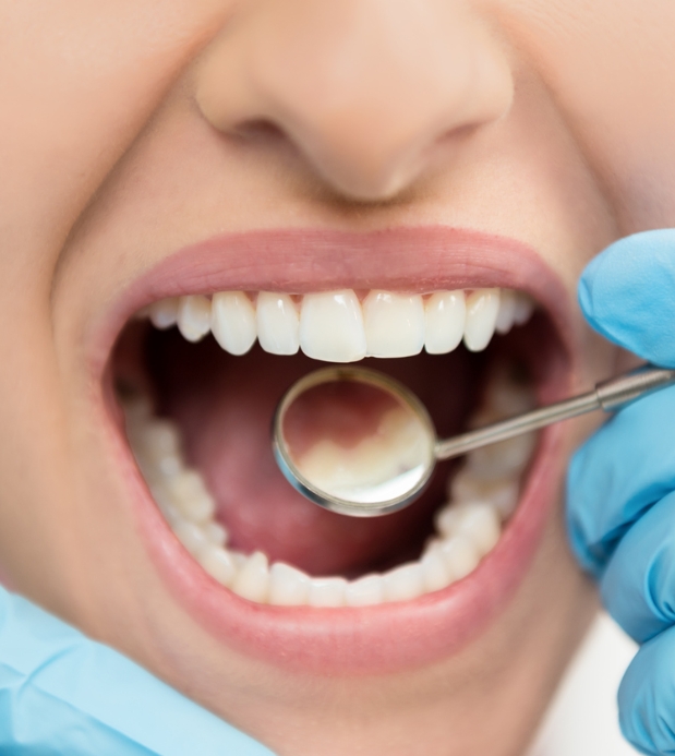 behandling efter tandhygienist